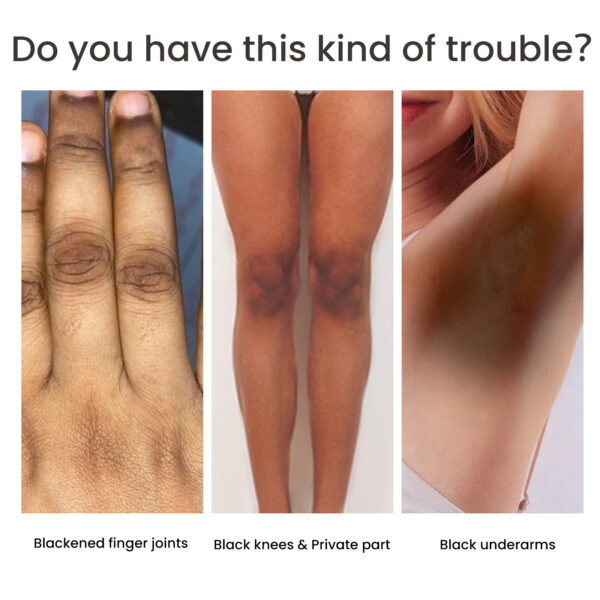 Women's Skin Pigmentation Care - Image 3